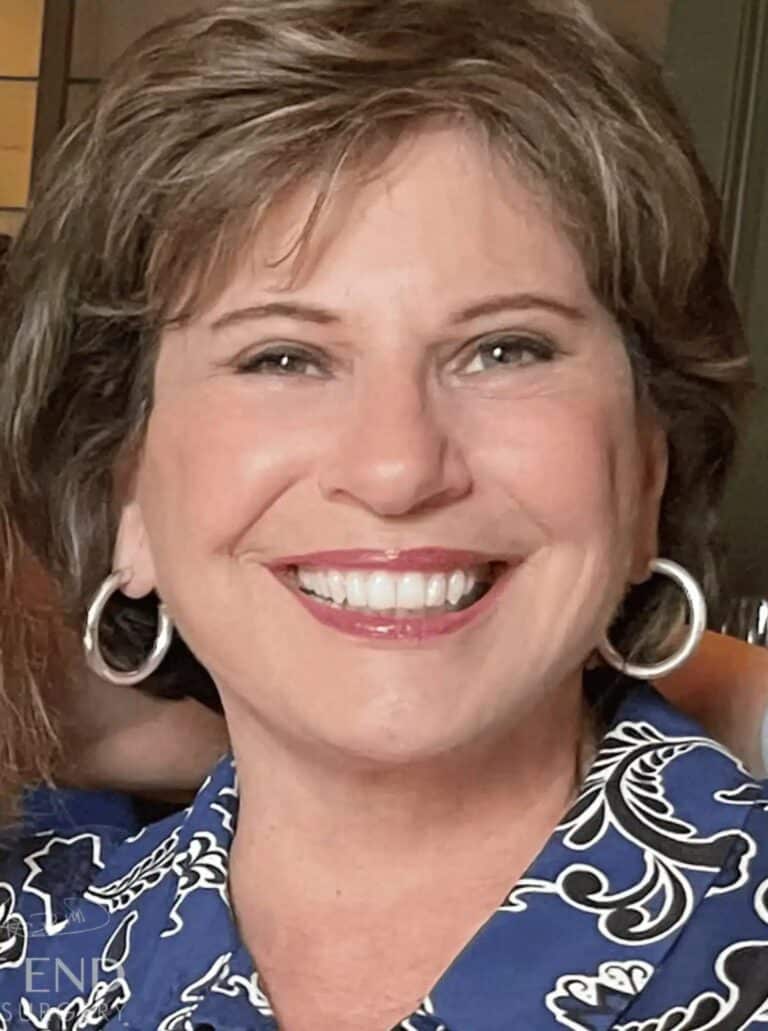 After Image: Deep Plane Facelift & Neck Lift, Brow Lift, Eyelid Lift, Fat Grafting, and CO2 Resurfacing (2.5 Months Post-Op) - front