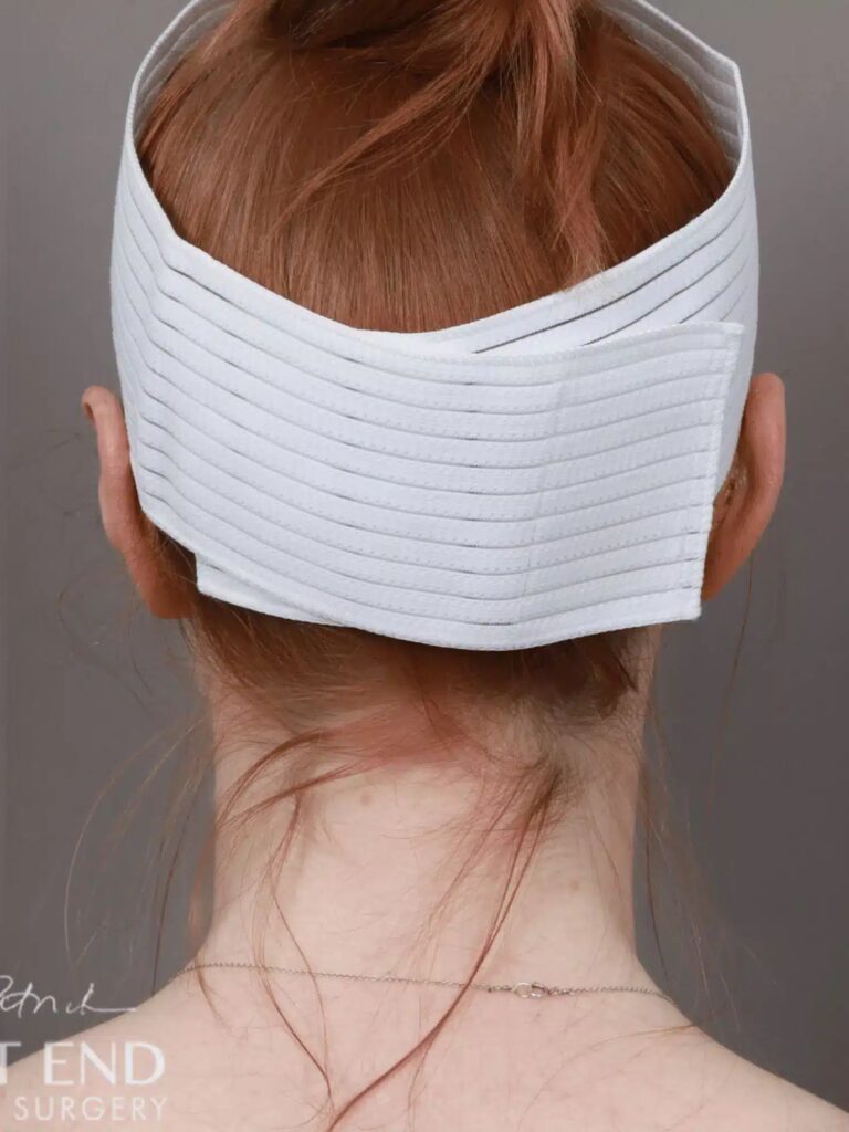 After Image: Otoplasty - back