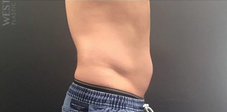 After Image: PHYSIQ - right-side