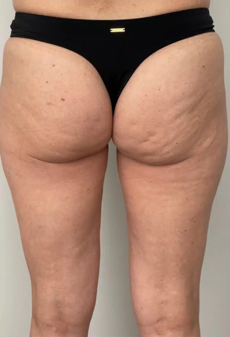 Before Image: PHYSIQ - back