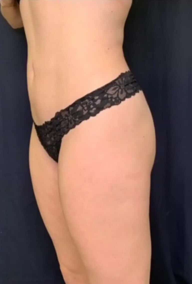 After Image: PHYSIQ - left-front-oblique
