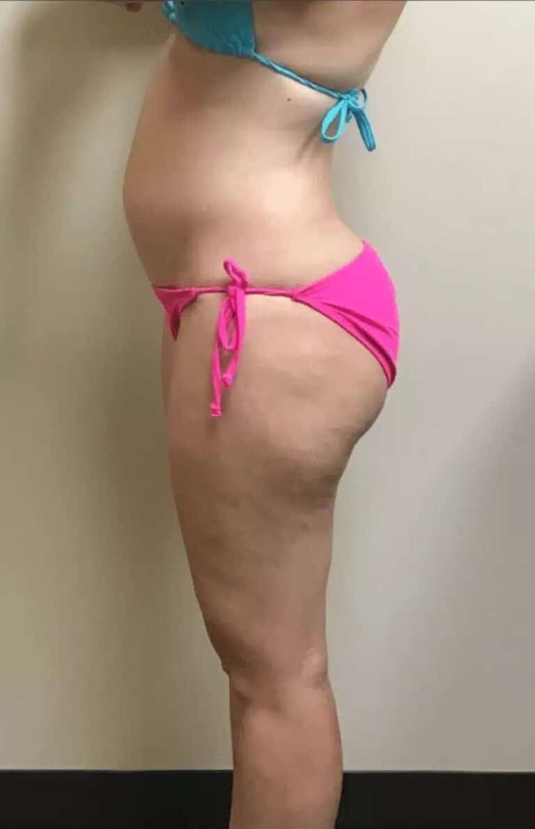 Before Image: PHYSIQ - left-side