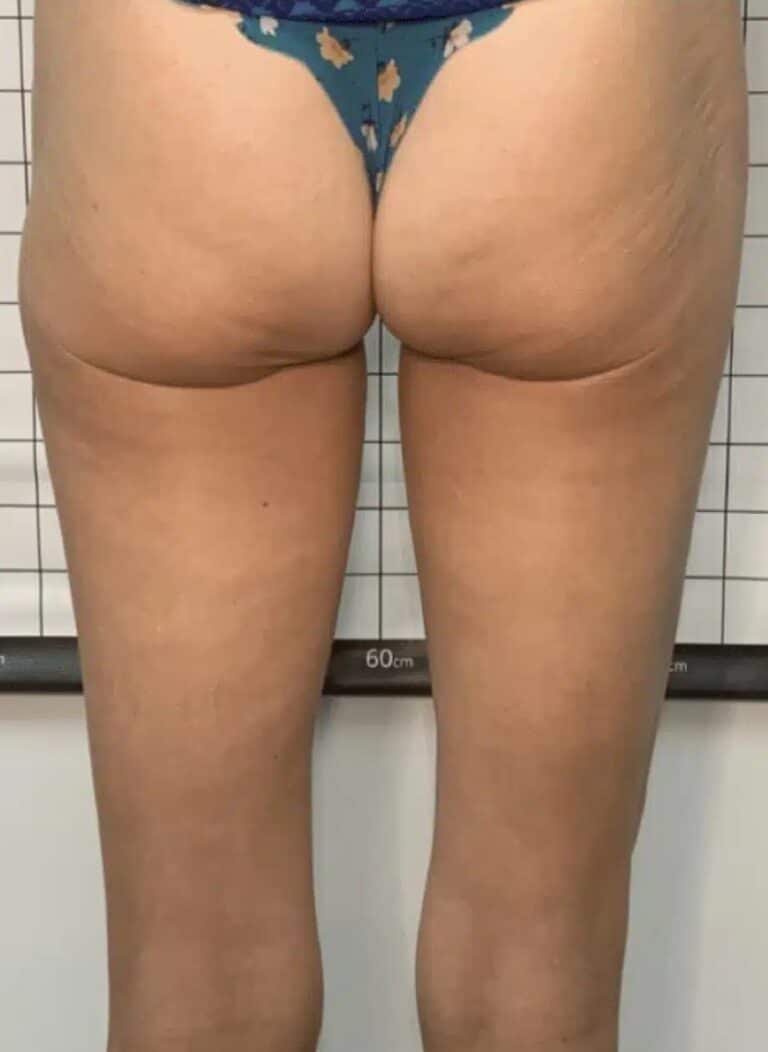 After Image: PHYSIQ - back