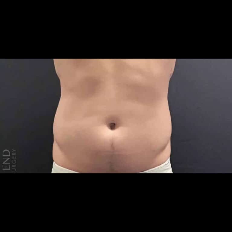 Before Image: PHYSIQ - front