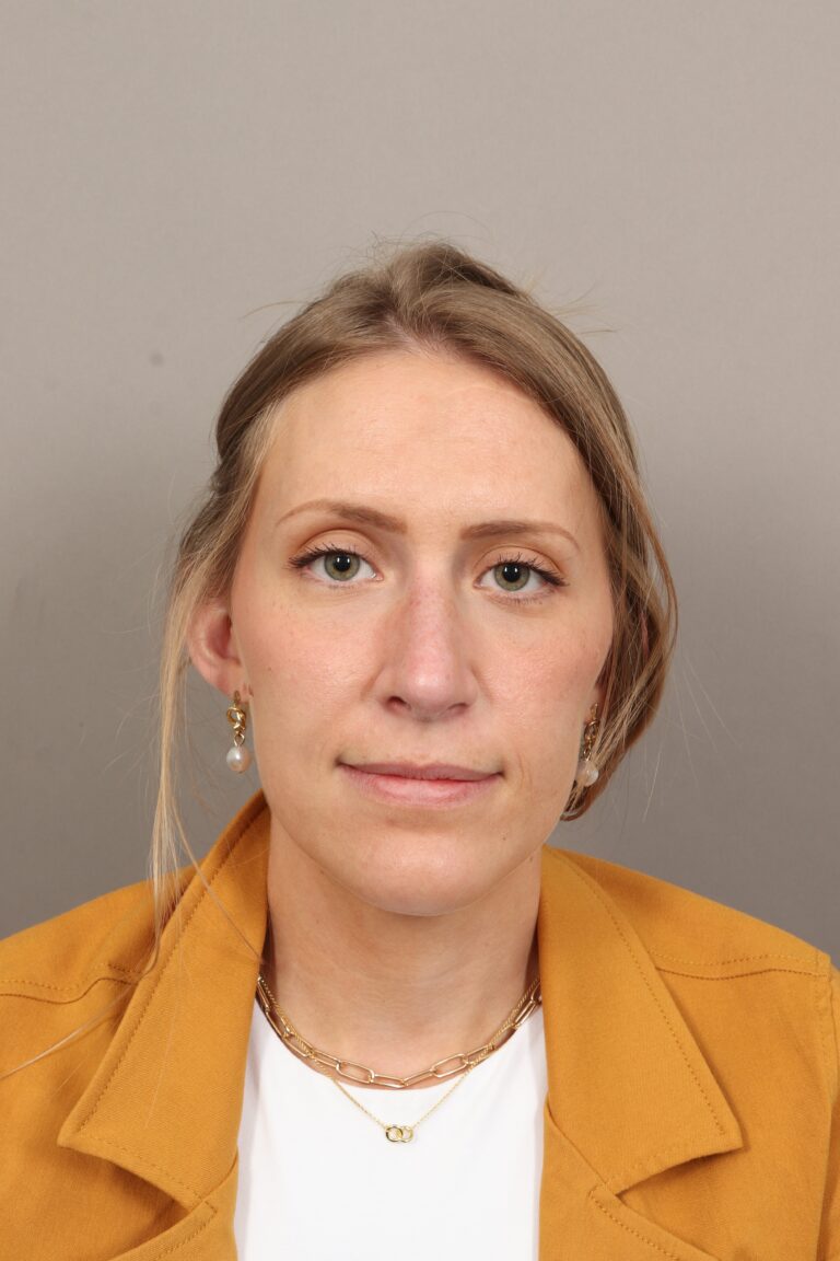 After Image: Rhinoplasty (3 Months Post-Op) -