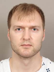 After Image: Jaw and Chin Augmentation (1 Year, 9 Months Post-Op)