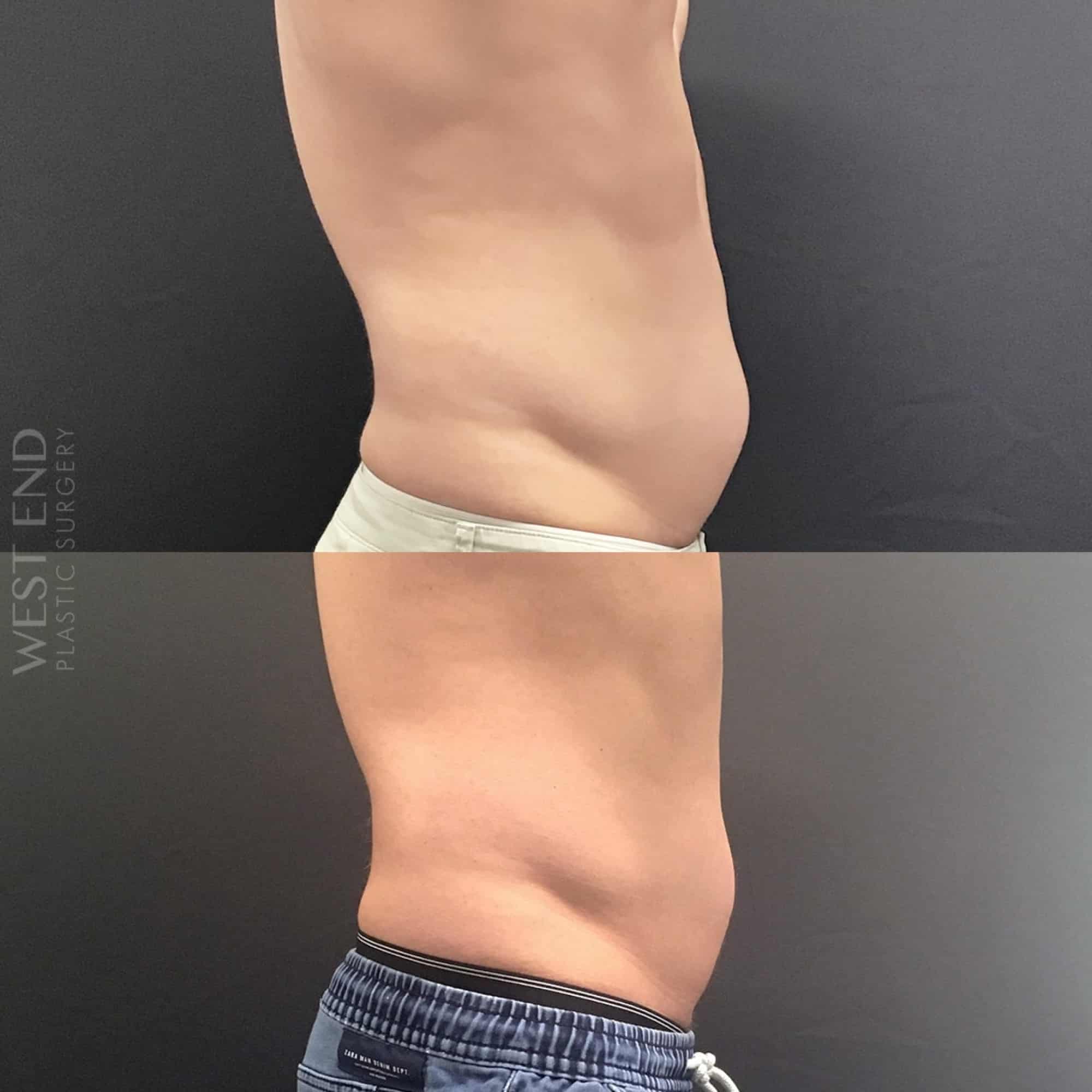 PHYSIQ