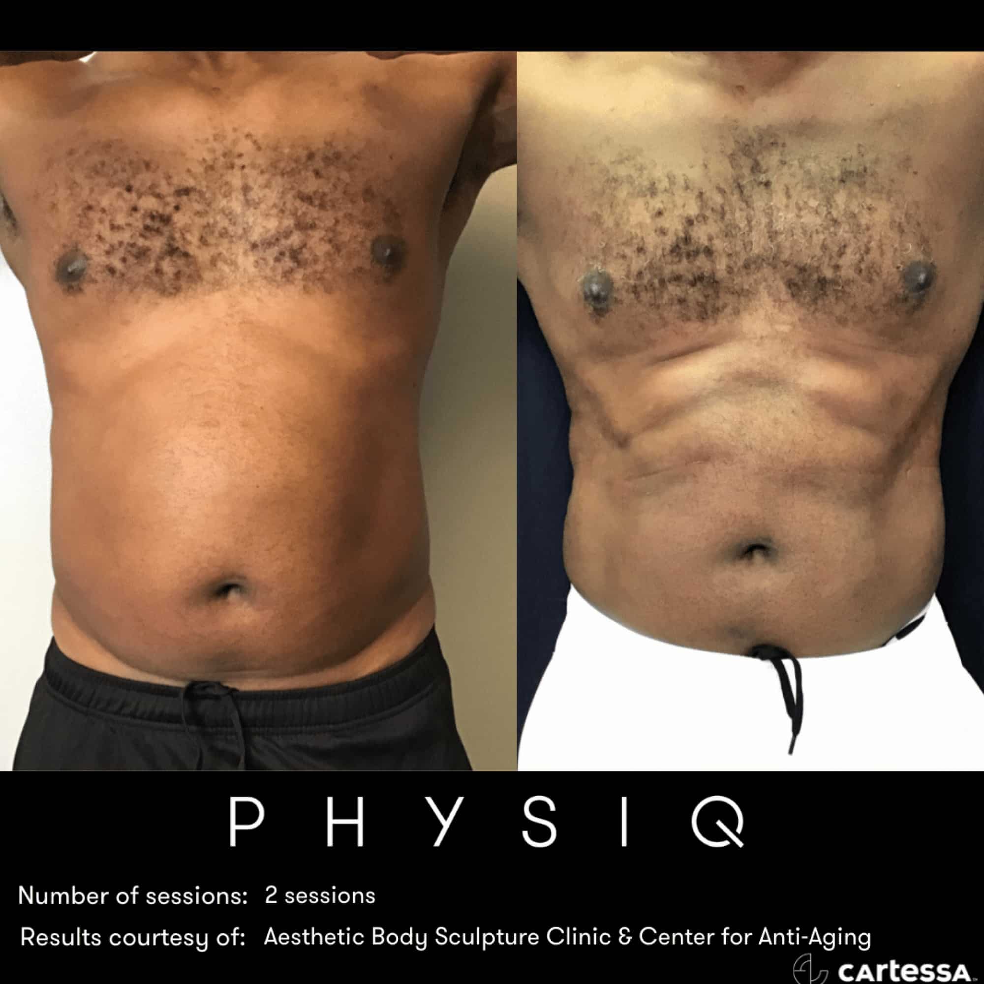 PHYSIQ