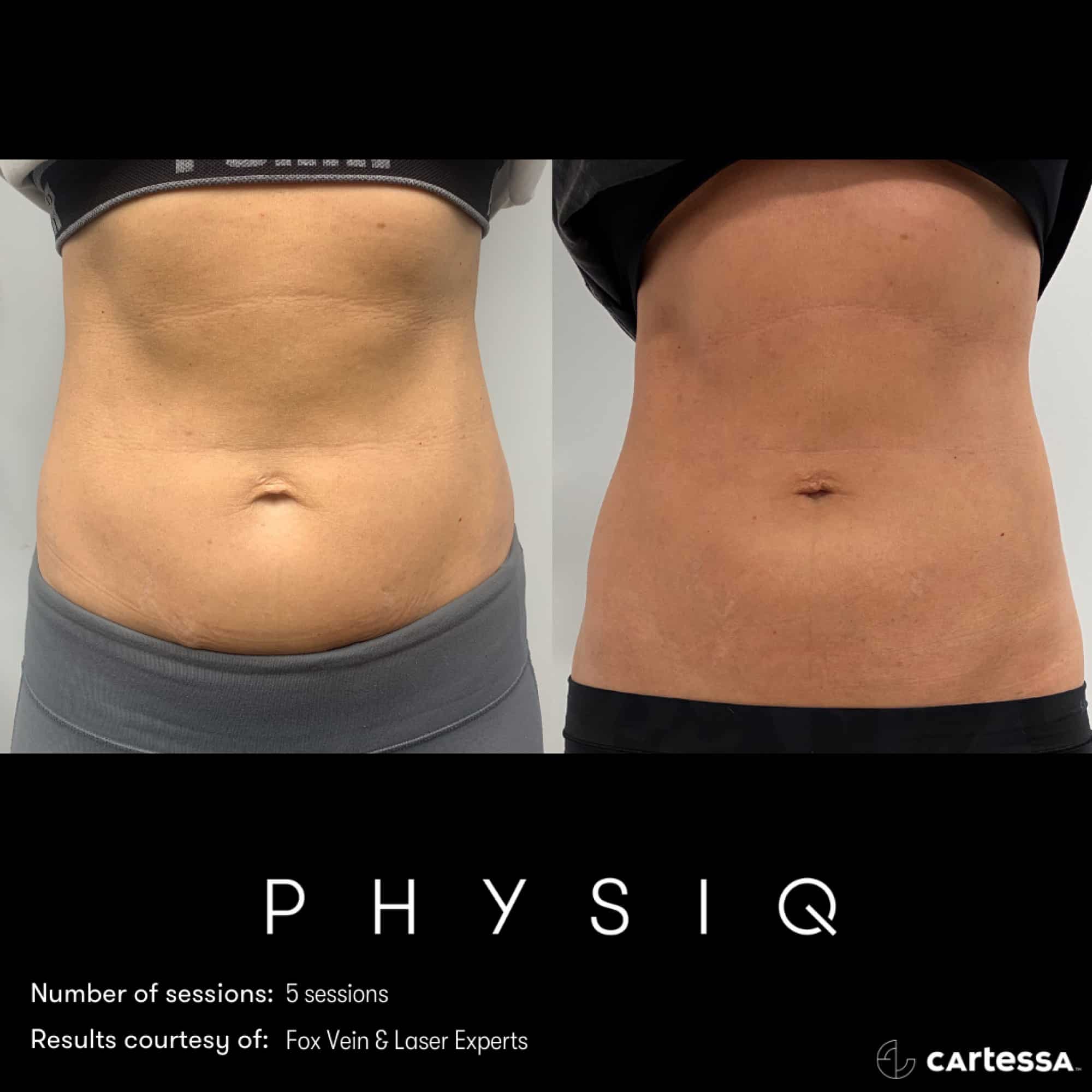 PHYSIQ