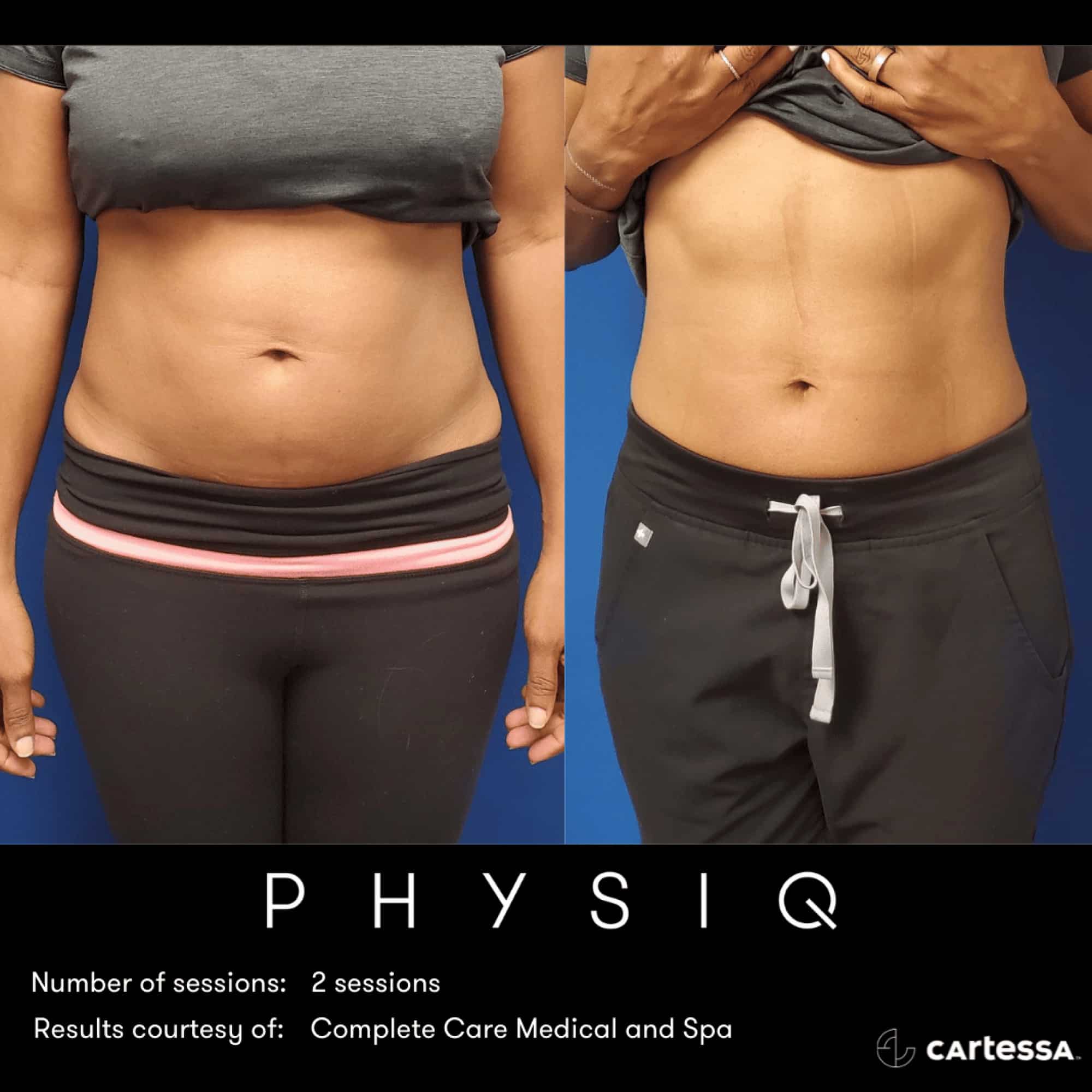 PHYSIQ