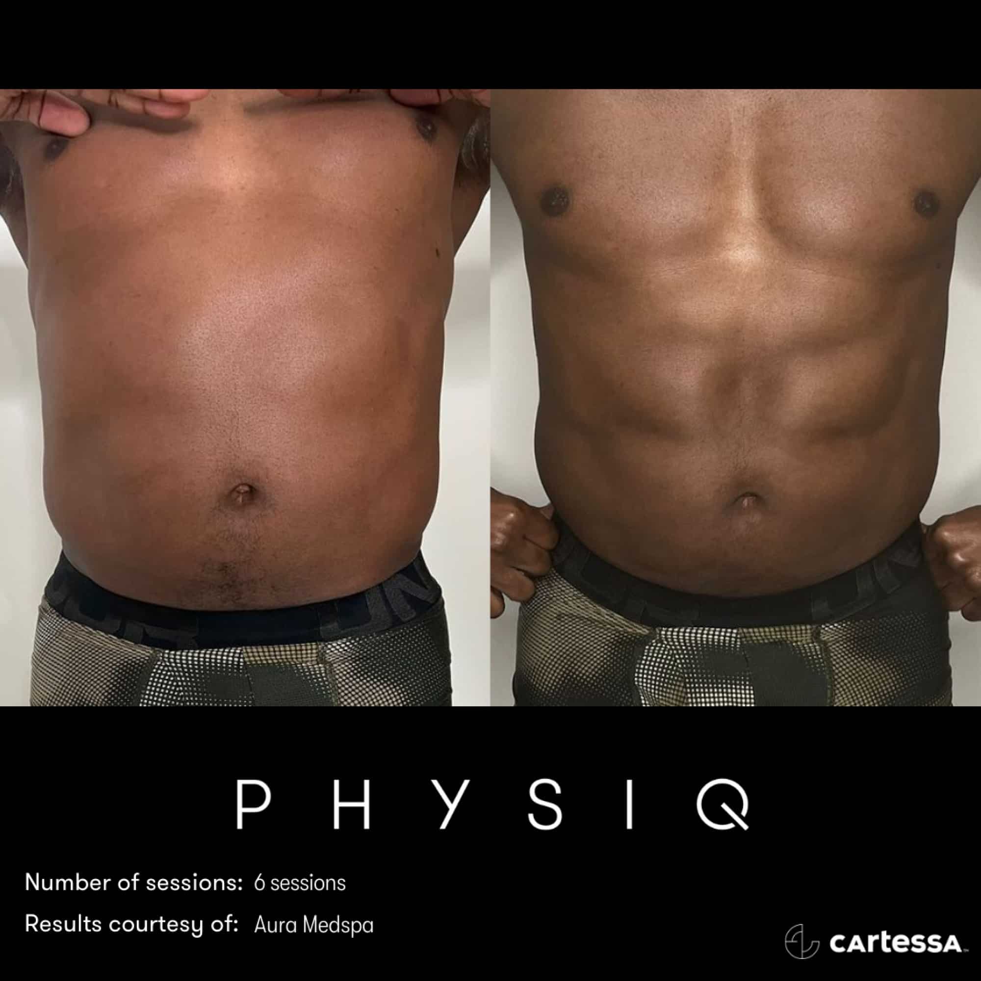 PHYSIQ