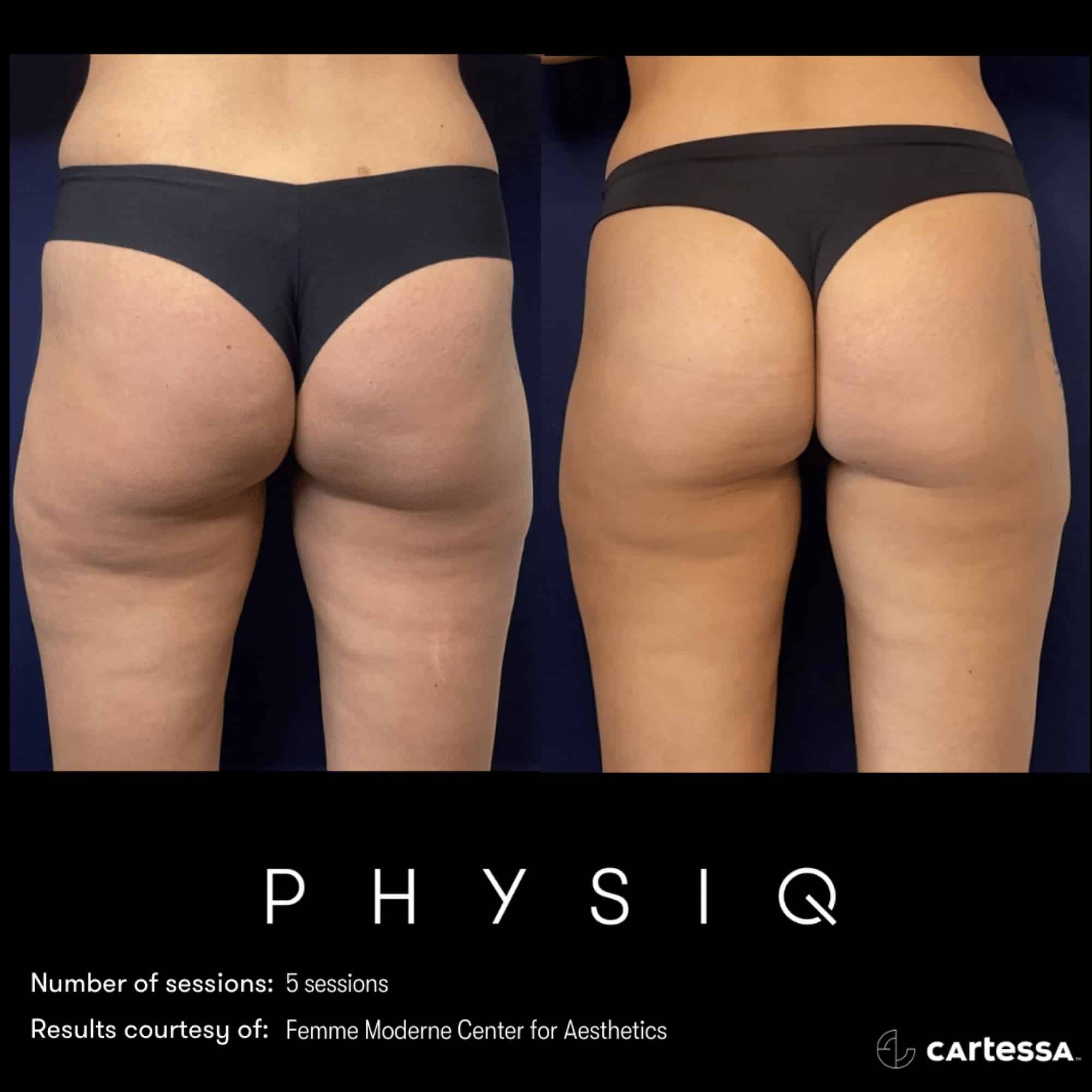 PHYSIQ