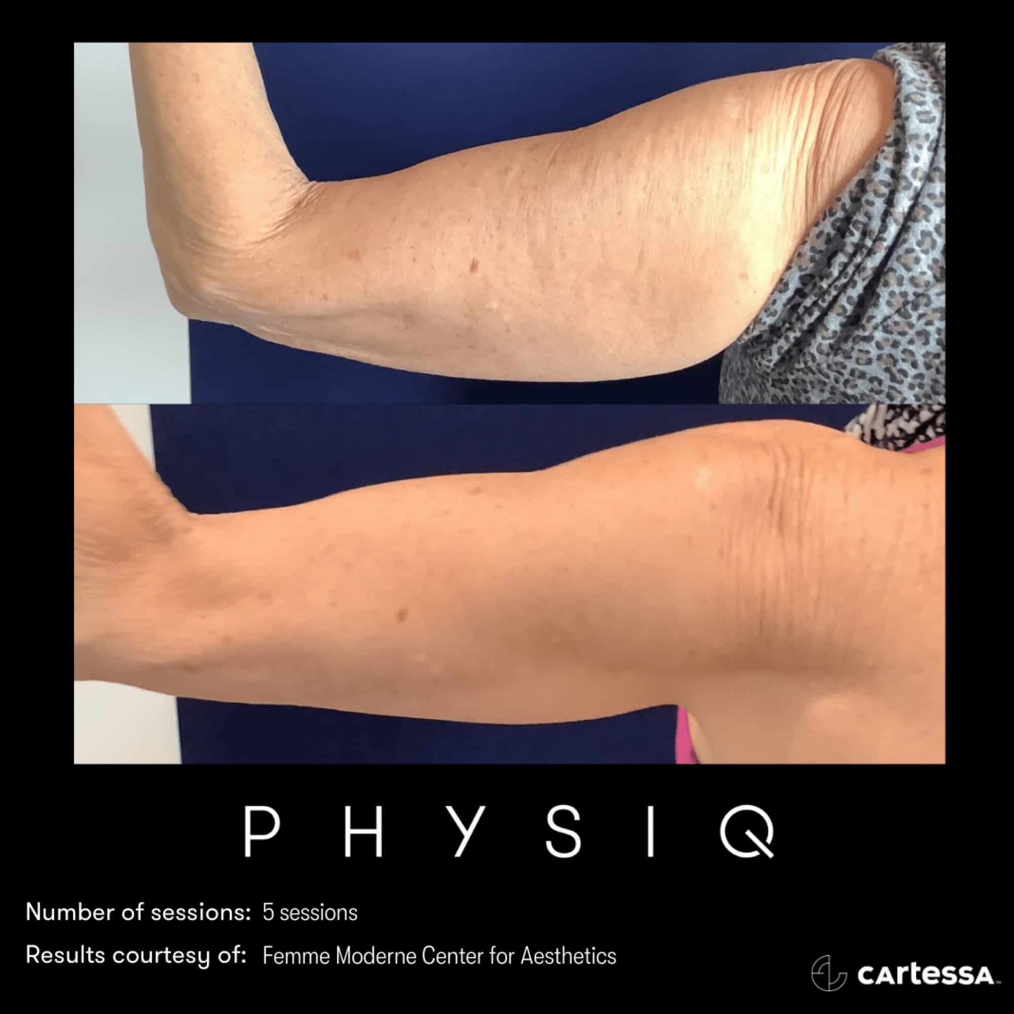 PHYSIQ