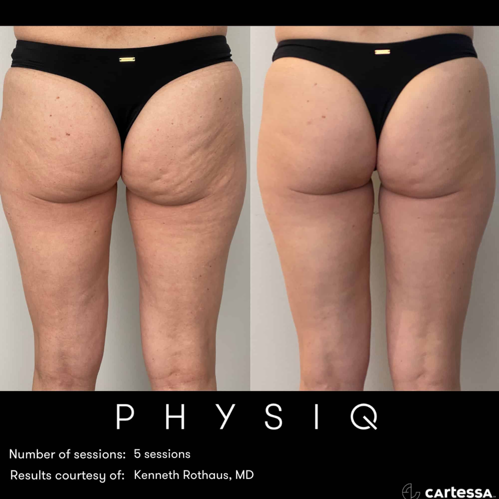 PHYSIQ