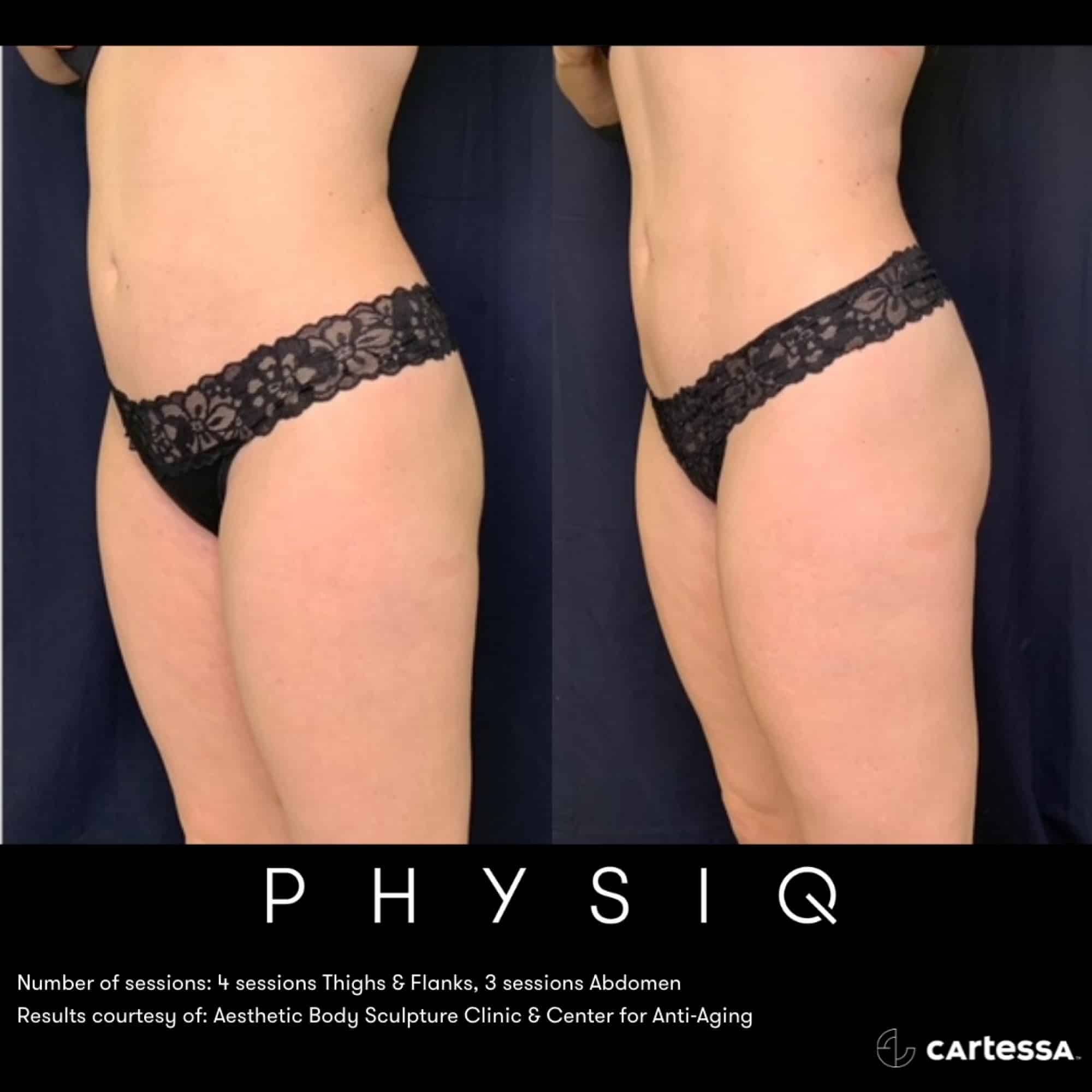 PHYSIQ