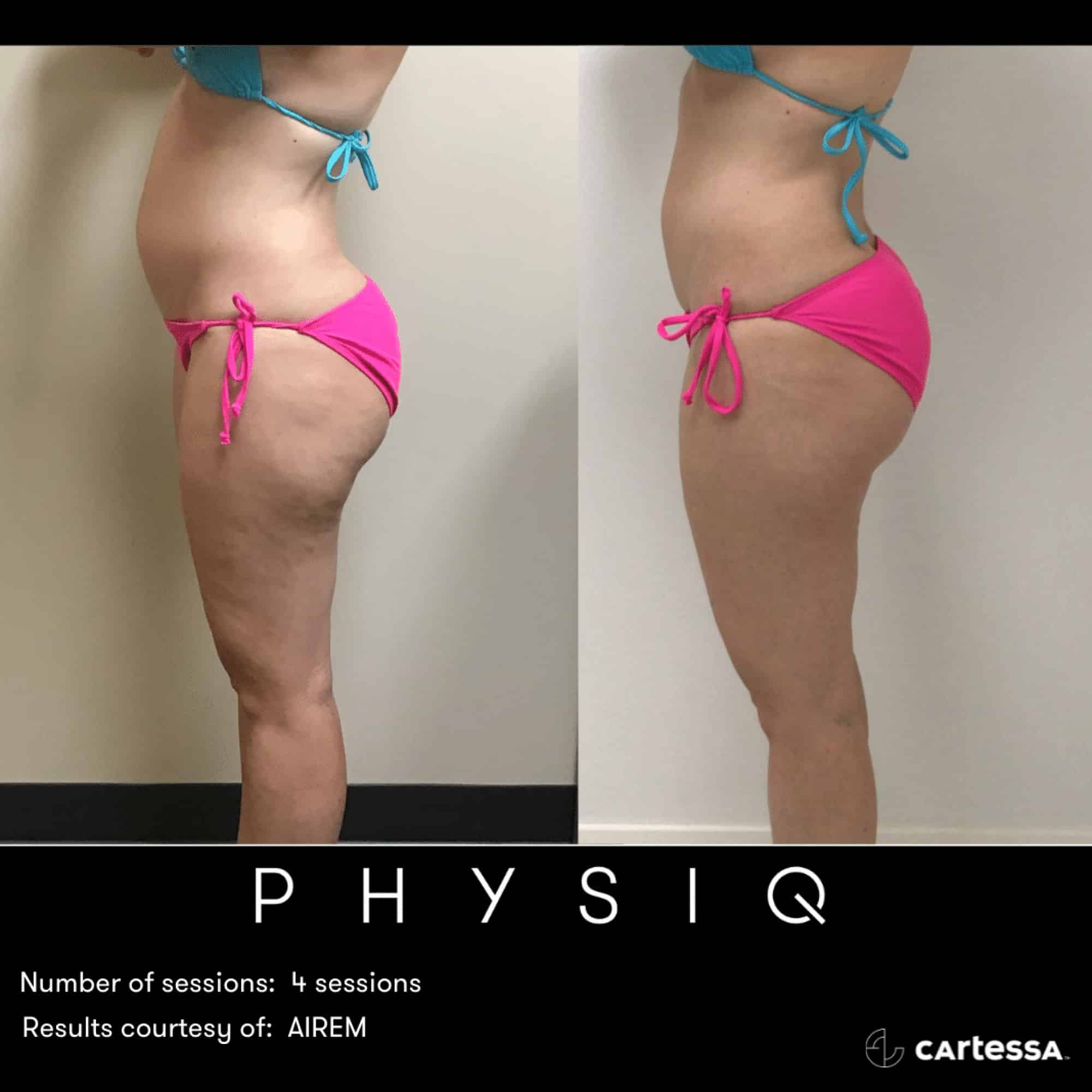 PHYSIQ