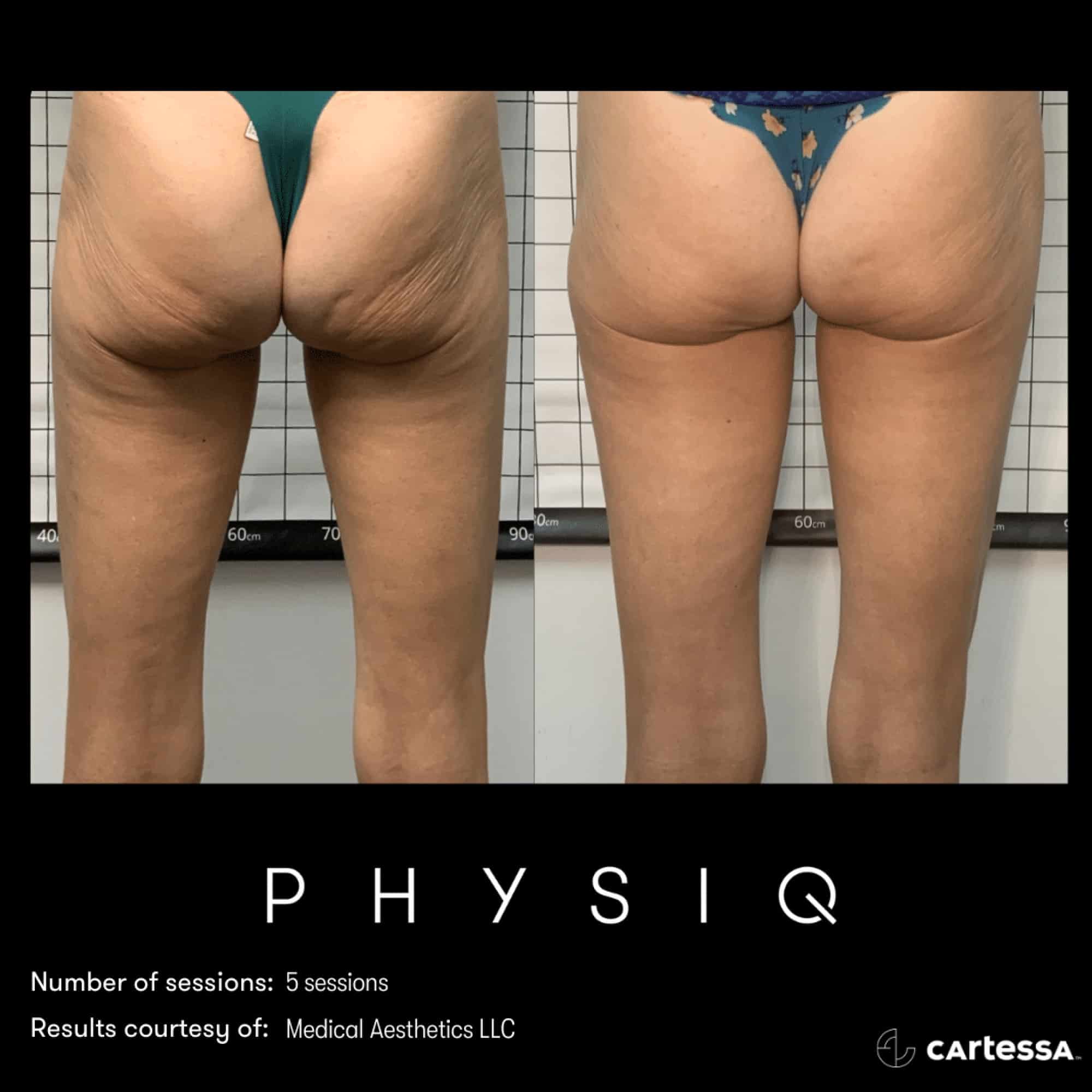 PHYSIQ