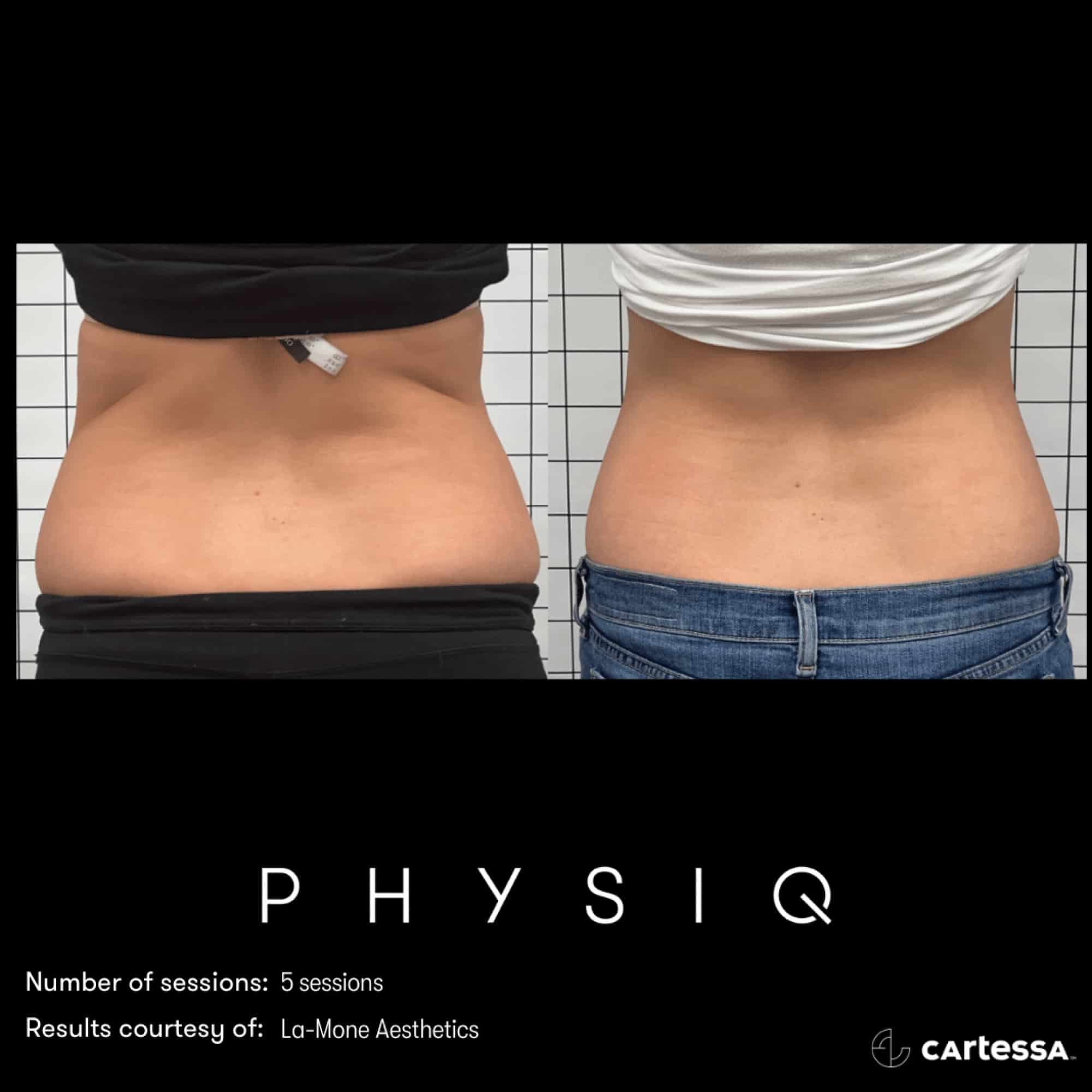 PHYSIQ